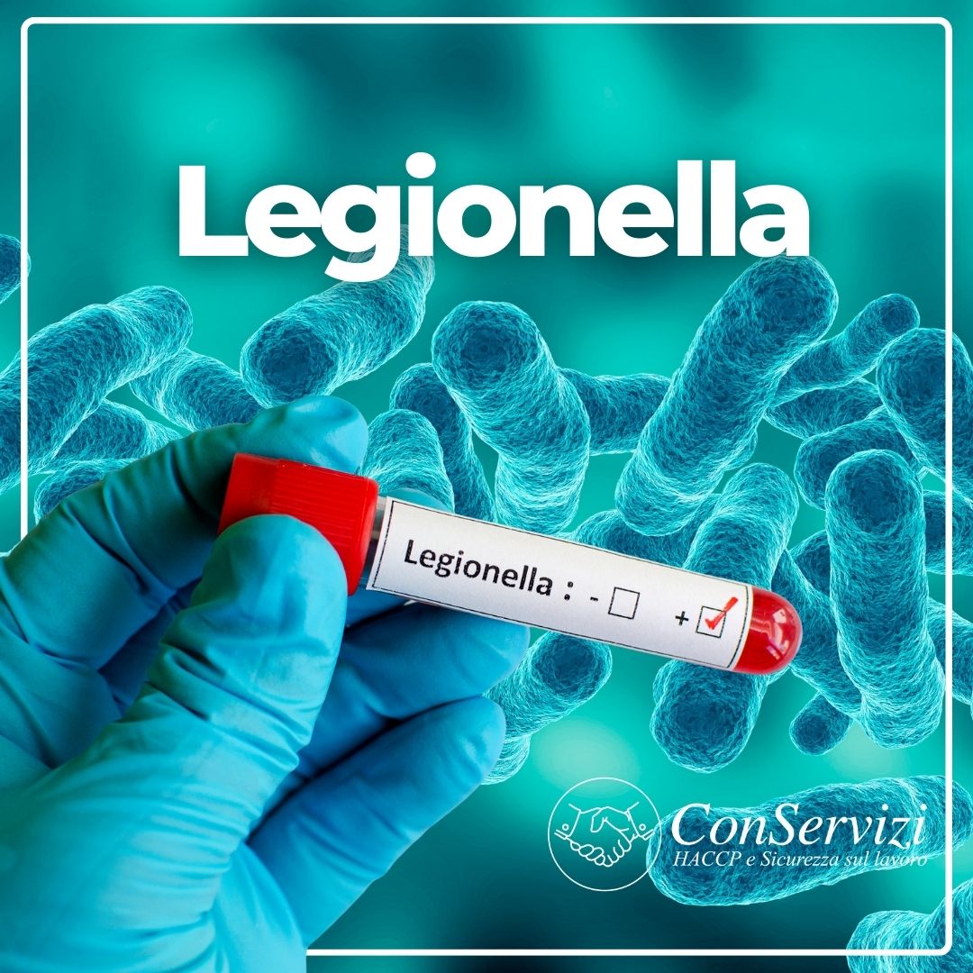Prevenzione e controllo della Legionella